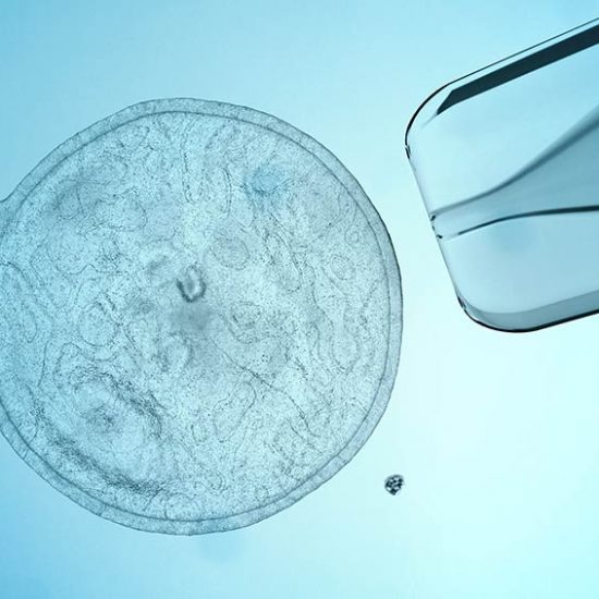 Stem Cell Therapy